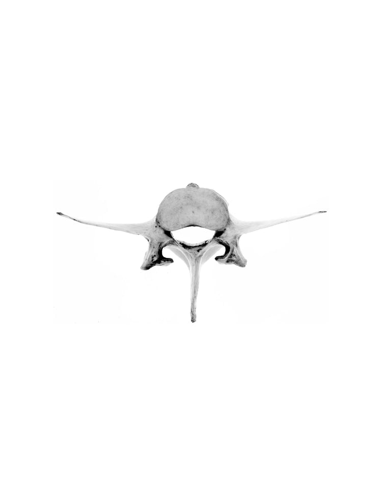 Photographie de Fernande Petitdemange : Tableaux de chassesuspendu, 2006, tirage argentique noir et blanc, format 40 x 50 cm, série de 5 photographies.